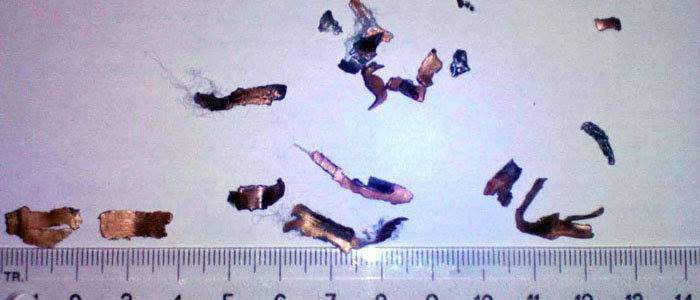 В Красногоровке дети пострадали из-за безответственности родителей