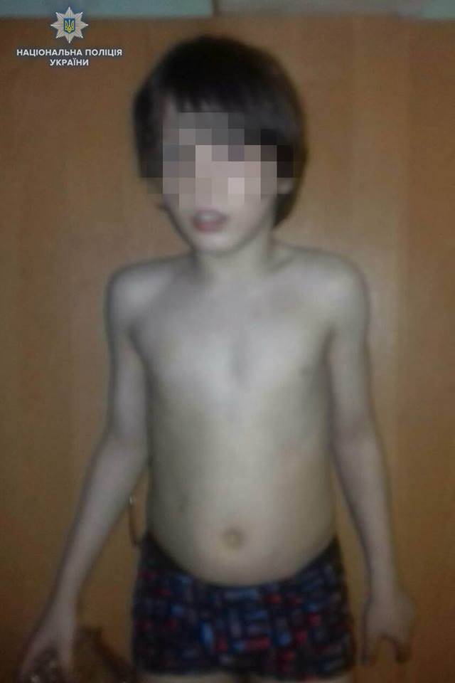 Лисичанские полицейские получили сообщение о том, что работники батальона полиции особого назначения «Скиф» на кв. Центральном в г. Лисичанск обнаружили ребенка 7-8 лет без одежды.