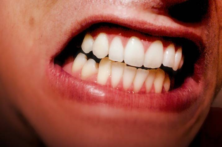 В Макеевке дебошир откусил женщине фрагмент носа