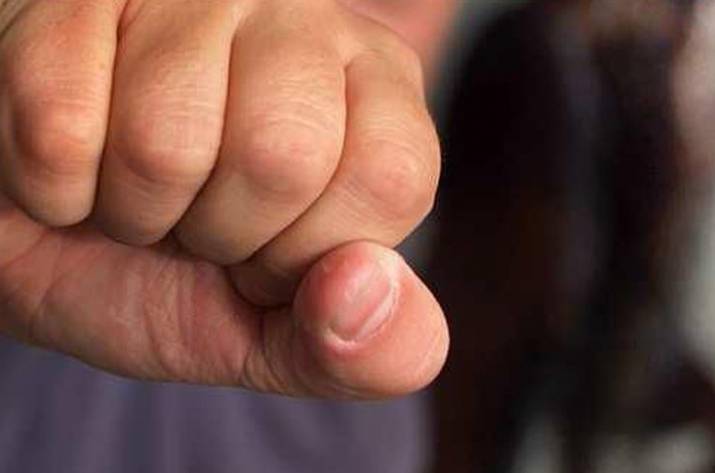 Житель Донецка находится в коме после избиения боевиками