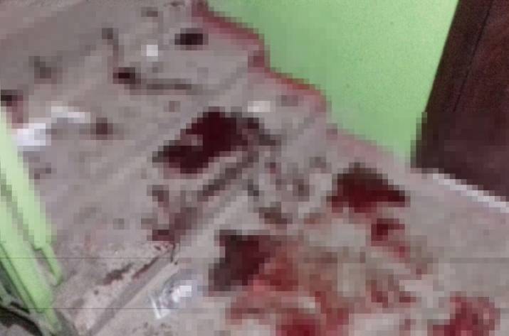 В оккупированном Харцызске подросток получил увечья, в результате взрыва.