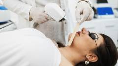 Лазерне шліфування обличчя взимку